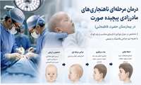 درمان ناهنجاری‌های نادر کرانیوفاشیال در بیمارستان حضرت فاطمه(س) تهران